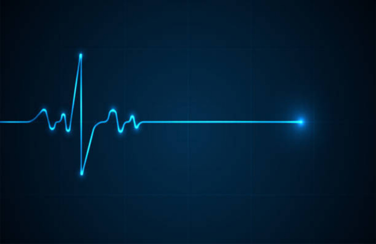 Monitoraggio con Elettrocardiogramma