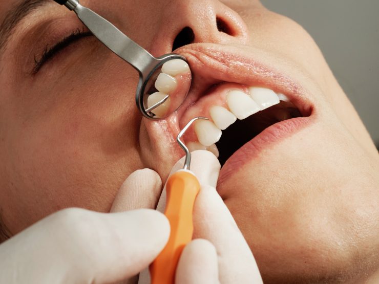 Dentista controlla i denti di una paziente